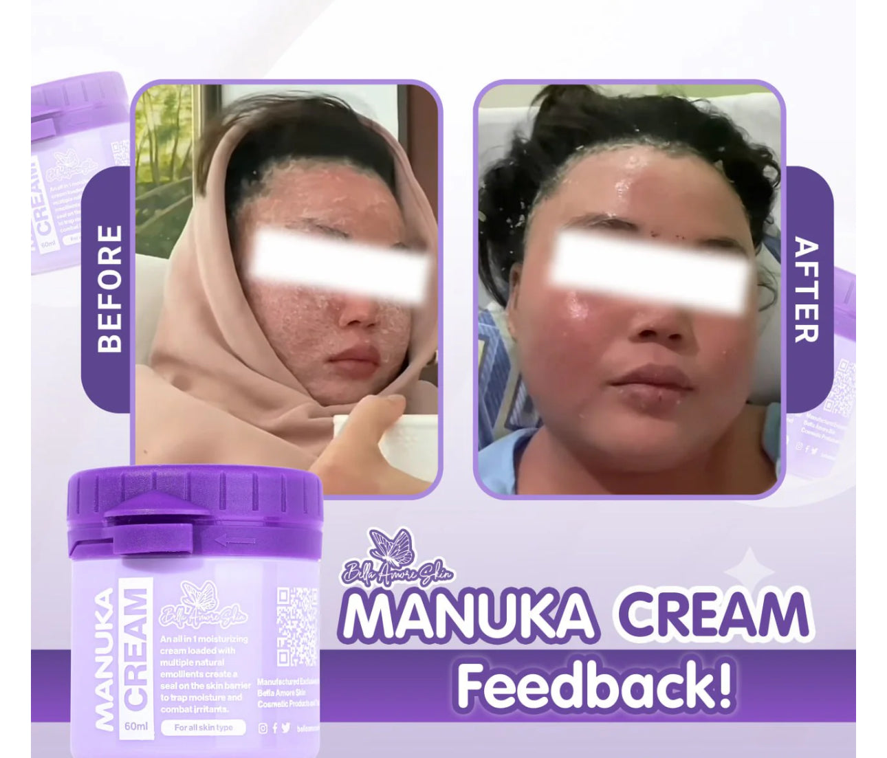 MANUKA CREAM